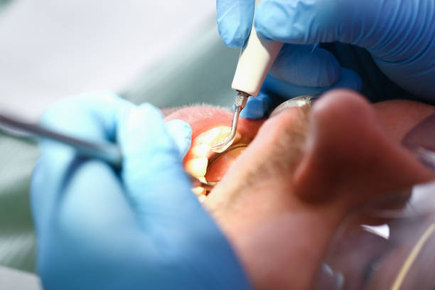 Best Same-Day Emergency Dental Services in Slaughterville, OK