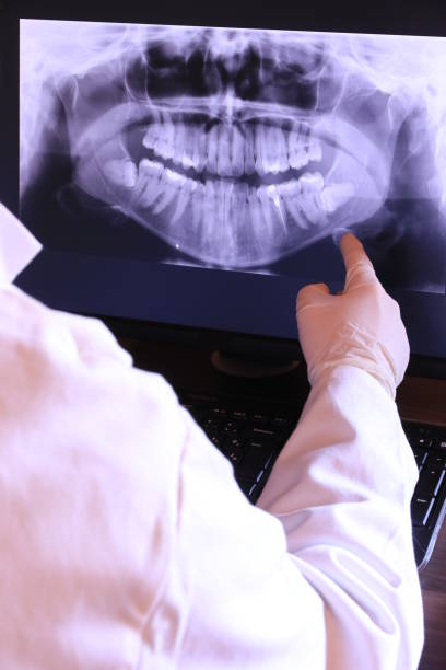 Best Emergency Treatment for Dental Infections or Abscesses in Slaughterville, OK
